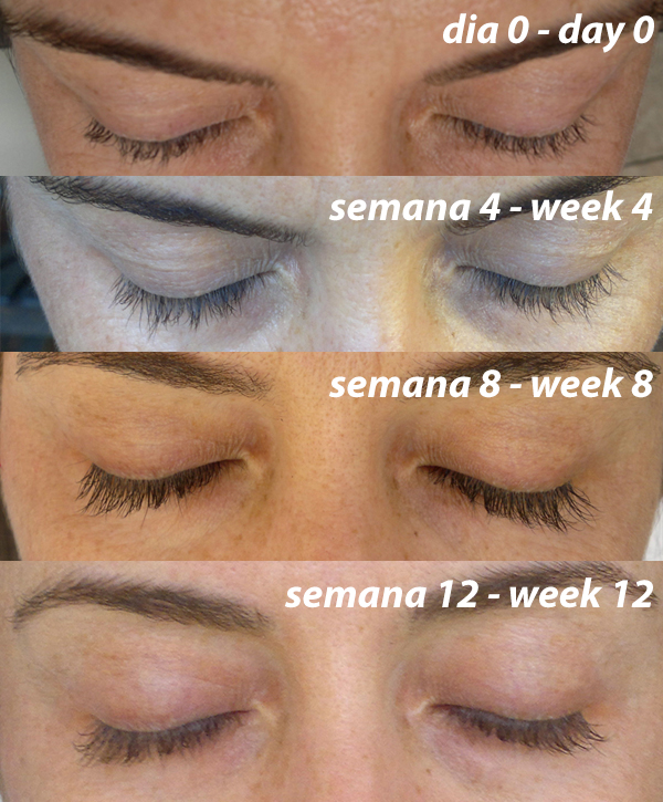 My Progress – My eyelashes are longer and thicker and darker.